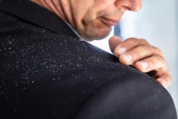 Đàn ông - Bí quyết giúp chàng trị gàu nhanh chóng tút lại vẻ bảnh bao đón Tết