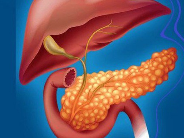 Sức khỏe đời sống - Uống rượu bia có thể mắc viêm tụy cấp gây tử vong nhanh chóng