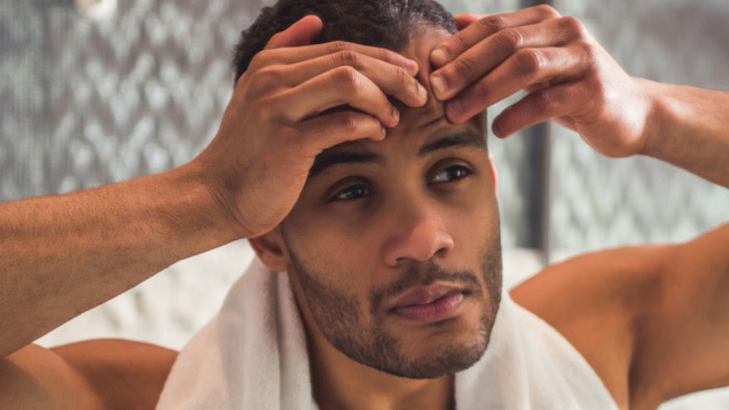 Những vấn đề về da nam giới hay gặp phải và cách khắc phục - 2