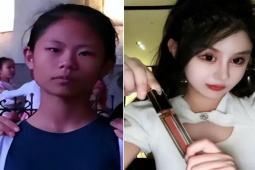 Bạn trẻ - Cuộc sống - Phẫu thuật "quá độ", cô gái nghiện làm đẹp từ năm 13 tuổi vô cùng hối hận vì quyết định bản thân