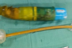 Sức khỏe đời sống - Nam thanh niên bị mắc kẹt đồ chơi tình dục dài 23 cm