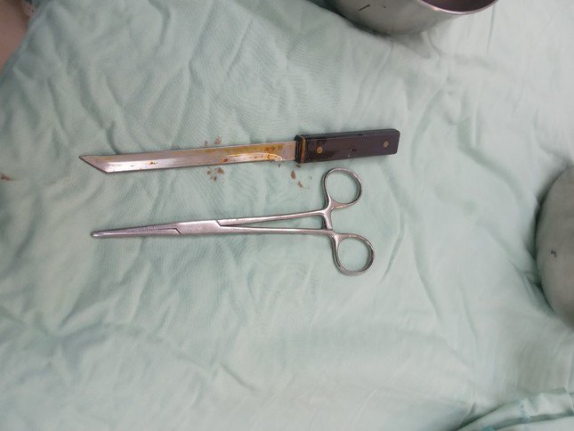 Con dao được các bác sĩ lấy ra khỏi bụng bệnh nhân.