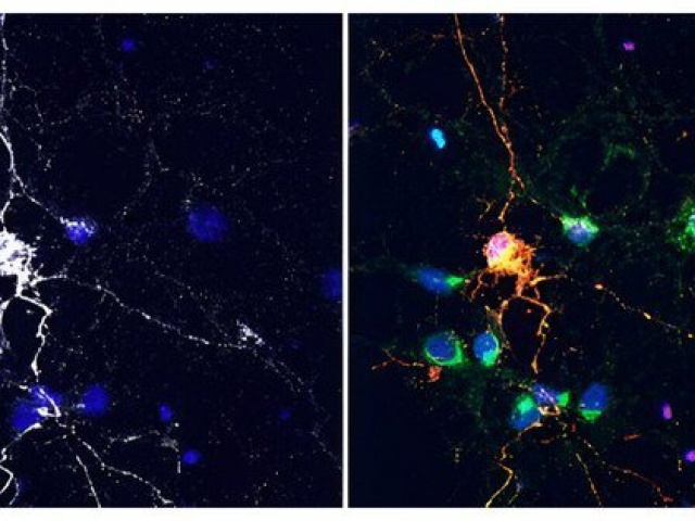 Sức khỏe đời sống - Mỹ: Nghiên cứu thuốc trị ung thư đạt được điều bất ngờ