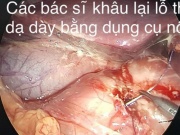 Sức khỏe đời sống - Nam sinh 15 tuổi bị thủng dạ dày vì thói quen ăn đồ chua cay