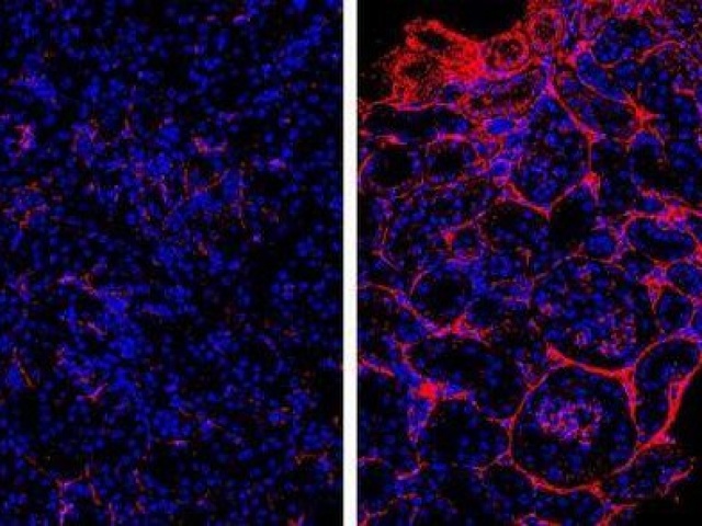 Sức khỏe đời sống - Đã tìm thấy 'chìa khóa' để thận luôn khỏe mạnh