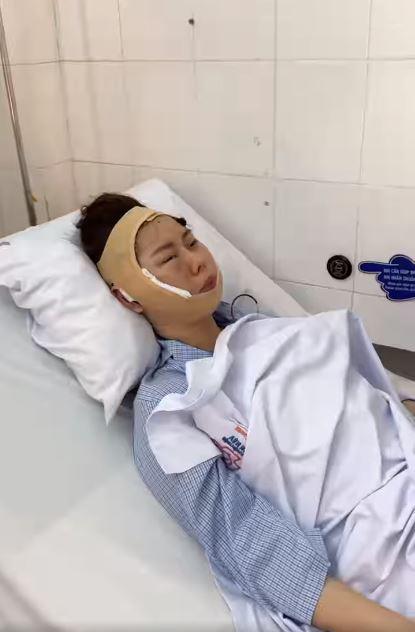 Gương mặt biến dạng của "chị Google" Việt Phương Thoa gây xôn xao - 1