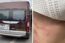 Tin tức trong ngày - Nữ hành khách kể lại phút bị nhà xe hành hung, bỏ rơi giữa cao tốc