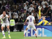 Bóng đá - Kết quả bóng đá Al Ain – Al Nassr: Tiếc nuối Ronaldo, áp lực lượt về (AFC Champions League)