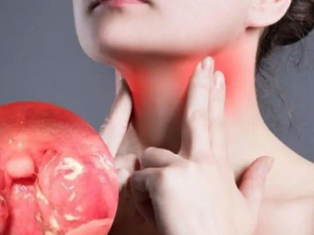 Bất ngờ 8 món ngon không nên ăn khi bị ho, viêm họng