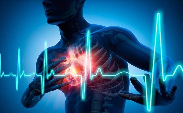Nhồi máu cơ tim là nguyên nhân gây tử vong phổ biến - Ảnh: SCITECH DAILY