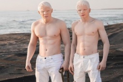 Đàn ông - Cặp anh em hiếm hoi sở hữu tóc bạch kim, da trắng muốt được mô tả như vị thần Hy Lạp