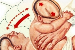 Sức khỏe đời sống - Bé 2 tháng tuổi bị tổn thương thần kinh vì hành vi người lớn thường làm mà không hay biết