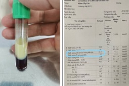 Sức khỏe đời sống - Người đàn ông có máu trắng như sữa vì lý do này