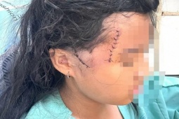 Pháp luật - 2 mẹ con bị người tình dùng dao chém trong đêm