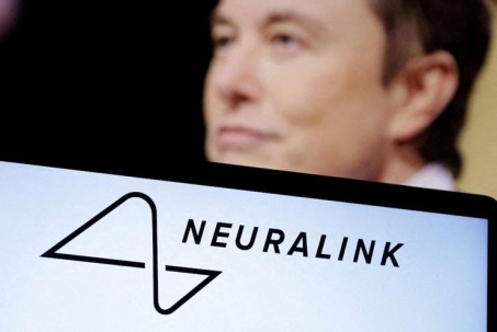 Người cấy chip não đầu tiên của Neuralink có thể chơi cờ bằng suy nghĩ