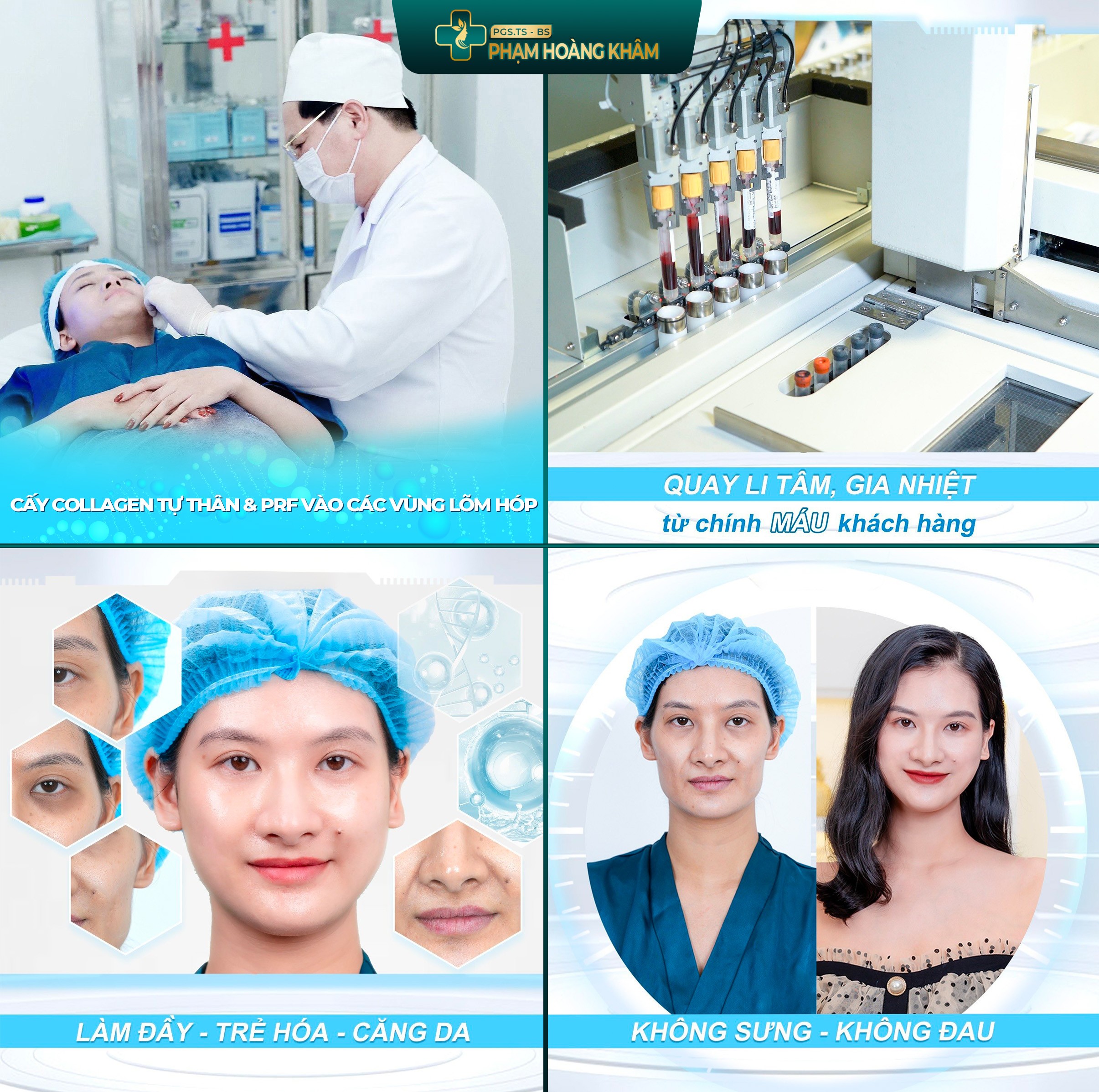 Khách hàng trải nghiệm 1 buổi làm Maxfill Nano