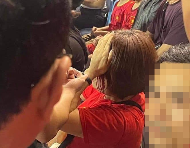 Nữ cổ động viên bị thương sau sự cố.