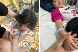 Video: Cắn bé gái 5 tuổi nhập viện và 3 người bị thương, con chó dữ bị tiêu hủy