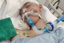 Pháp luật - Vụ nam sinh lớp 8 bị đánh chết não: Công an cảnh báo việc đăng tải sai bản chất sự việc