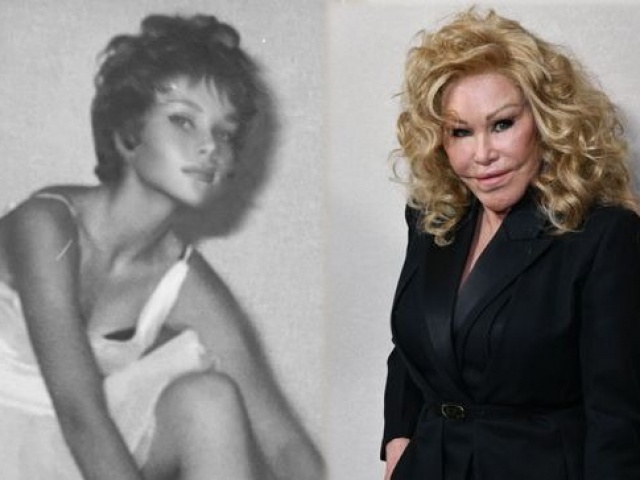 Lý do cựu tỷ phú Jocelyn Wildenstein phẫu thuật mắt mèo