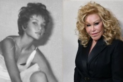 Lý do cựu tỷ phú Jocelyn Wildenstein phẫu thuật mắt mèo