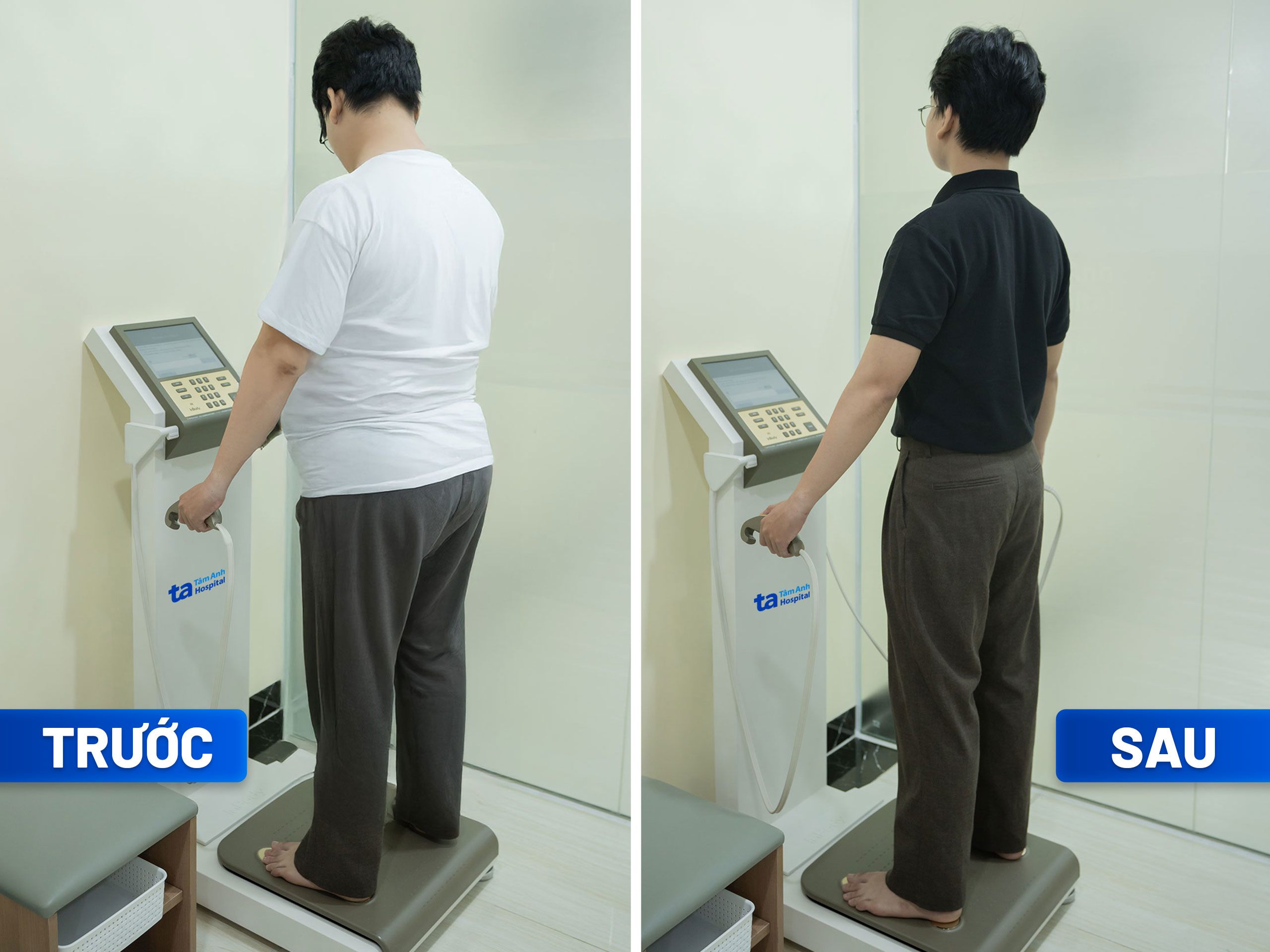 Khách hàng được đo chỉ số cơ thể (InBody) trước và sau điều trị giảm cân để theo dõi sự tình trạng mỡ nội tạng, tỷ lệ mỡ và khối cơ đang diễn tiến thế nào suốt liệu trình giảm cân. Ảnh: BVĐK Tâm Anh