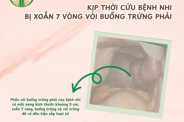 Bé 13 tuổi ở Bình Dương suýt bị hoại tử buồng trứng từ dấu hiệu nhiều người Việt bỏ qua - 1