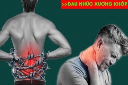 Tin tức sức khỏe - Người đau lưng, thoái hóa cột sống chọn gối kỹ hơn “chọn bạn đời” - Sự thật phía sau ?