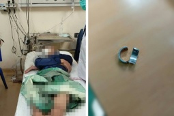 Bạn trẻ - Cuộc sống - Nghịch dại đeo nhẫn vào “của quý”, chàng trai phải nhờ trợ giúp của bác sỹ và lính cứu hỏa