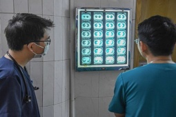 Phổi trắng - dấu hiệu đặc trưng của bệnh nhân mắc cúm nặng