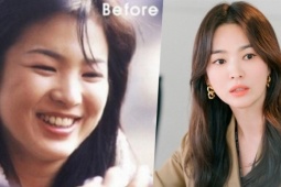 Hai món Song Hye Kyo ăn thay cơm để giảm cân