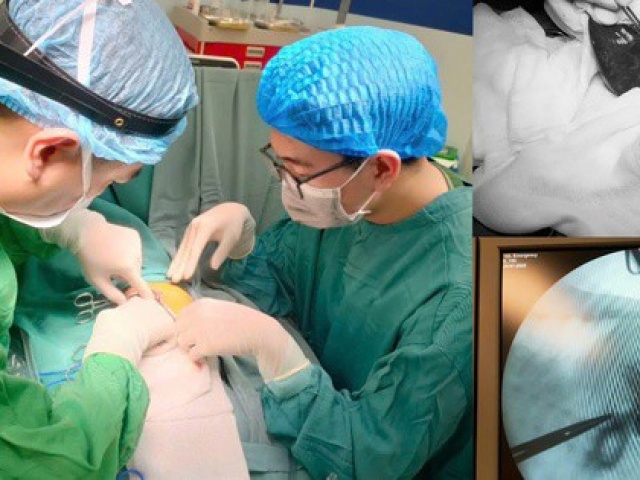 Bé 1 tháng tuổi mắc bệnh hiếm 10.000 trẻ sinh ra mới có 1 trẻ bị