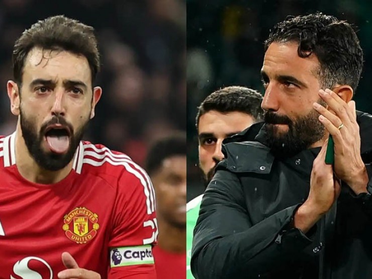 Rào cản ở MU: Amorim loay hoay sơ đồ 3-4-3, Fernandes gợi nhớ “hội chứng Gerrard“