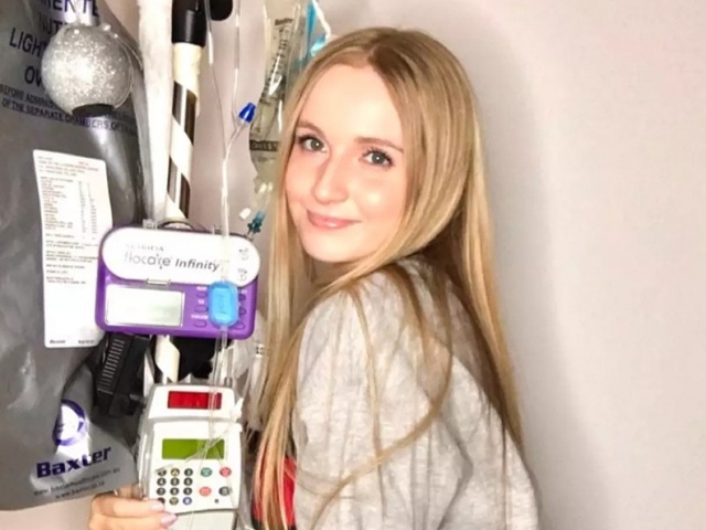 Bệnh lạ khiến cô gái không ăn trong 10 năm