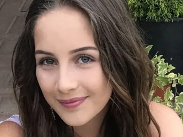 Căn bệnh lạ khiến cô gái bỏng mặt khi cười