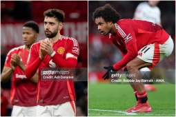 Bóng đá - MU bị loại khỏi FA Cup: Khi &quot;ông lớn&quot; chỉ còn là danh hão, Fernandes cô đơn