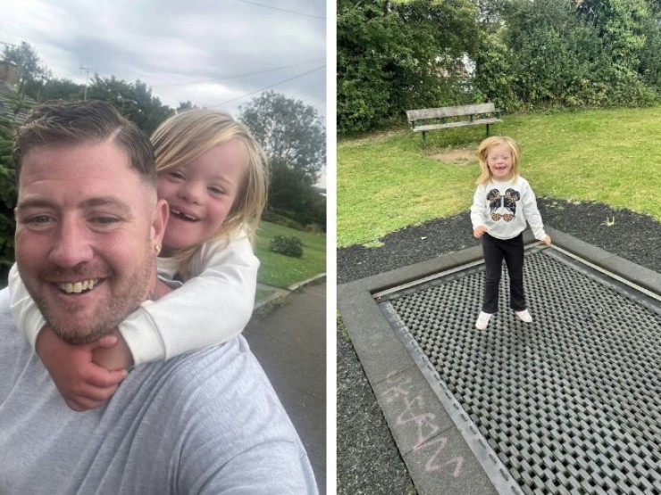 Bé gái 7 tuổi chơi đột quỵ khi chơi cầu trượt, bác sĩ phải cắt bỏ 1/3 hộp sọ để cứu mạng