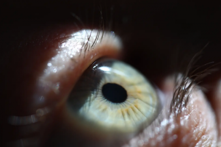 Cấy răng vào mắt chữa mù lòa