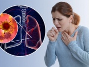 Bác sĩ cảnh báo 5 căn bệnh dễ mắc khi trời nồm ẩm