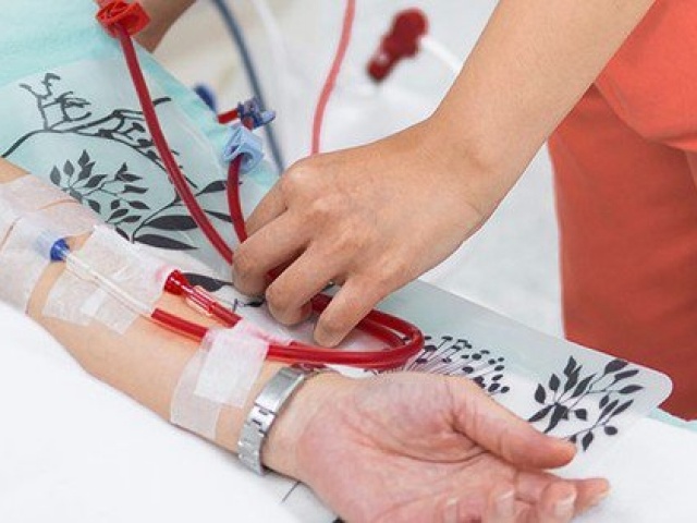 Cô gái nửa năm giảm 20 cân, suy thận giai đoạn cuối vì chủ quan