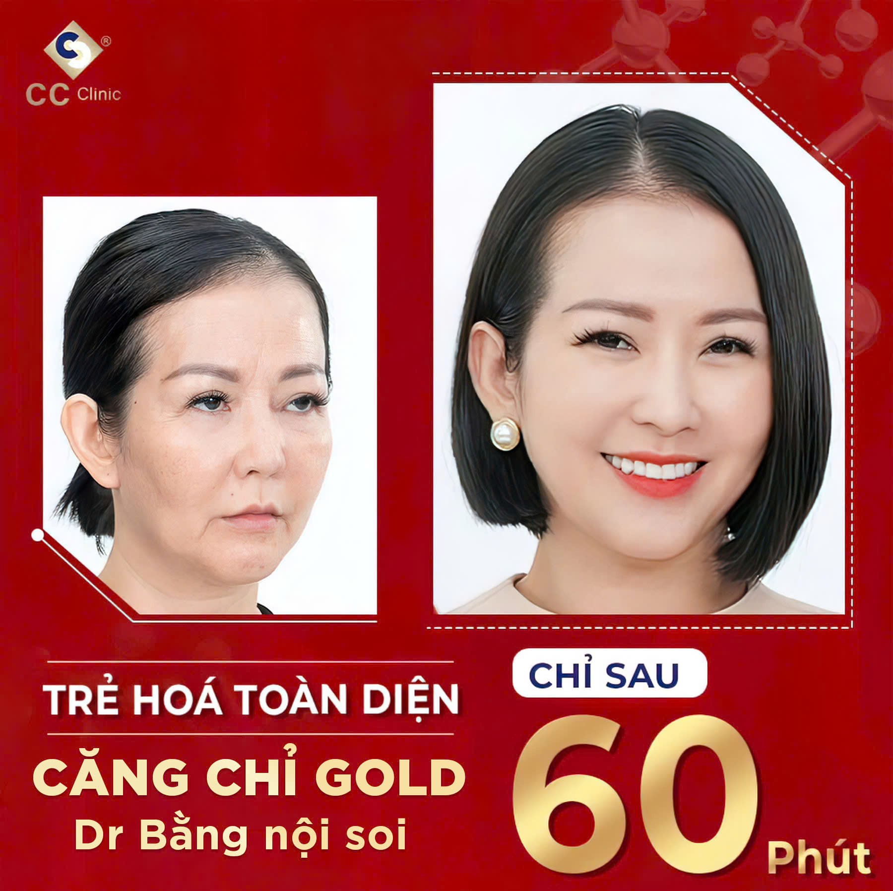 Thẩm mỹ CC - Lấy lại làn da tuổi thanh xuân