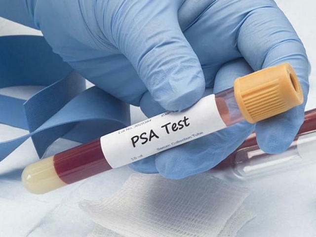 Quan hệ thường xuyên có thể ngừa ung thư tuyến tiền liệt?