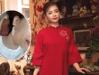 Dương Hoàng Yến đau đớn khi điều trị liệt dây thần kinh số 7