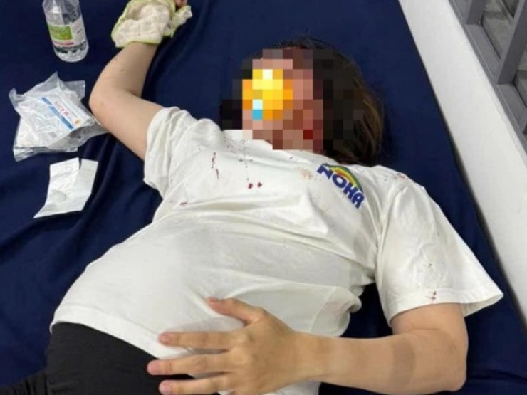 Clip hơn 1 phút ghi lại cảnh bà bầu và nam thanh niên bị đánh dã man chỉ vì trẻ con giành đồ chơi