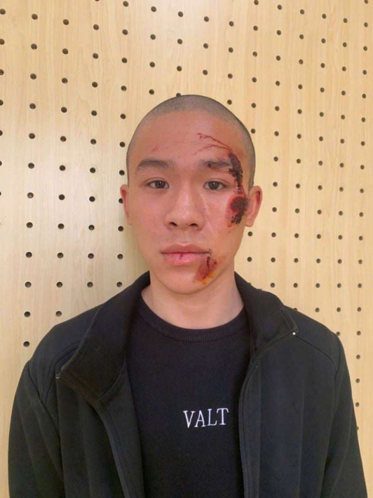 Nguyễn Anh Tuấn (sinh năm 2007, trú tại Tổ dân phố Đầm Vạc, phường Vĩnh Phúc). Ảnh: CAPT