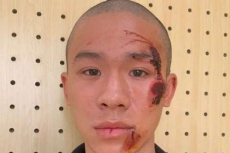 Một cảnh sát giao thông bị đối tượng lao xe "thông chốt" hất văng ra đường, gây thương tích