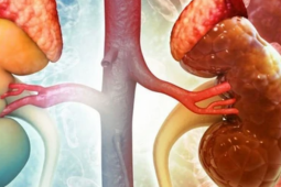 Thanh niên 30 tuổi đang khỏe mạnh sững sờ phát hiện suy thận: 'Tôi không hề đau, không mệt, sinh hoạt bình thường'