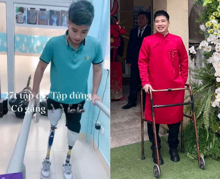 Sau nhiều năm nỗ lực, Công Luận đã tự tin đi bằng "đôi chân mới"&nbsp;