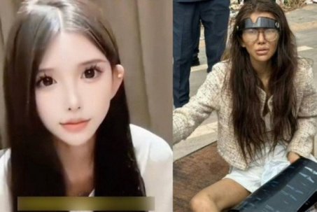 Bị lừa bán sang Campuchia, mỹ nhân mạng trở thành 'bà điên' trên phố