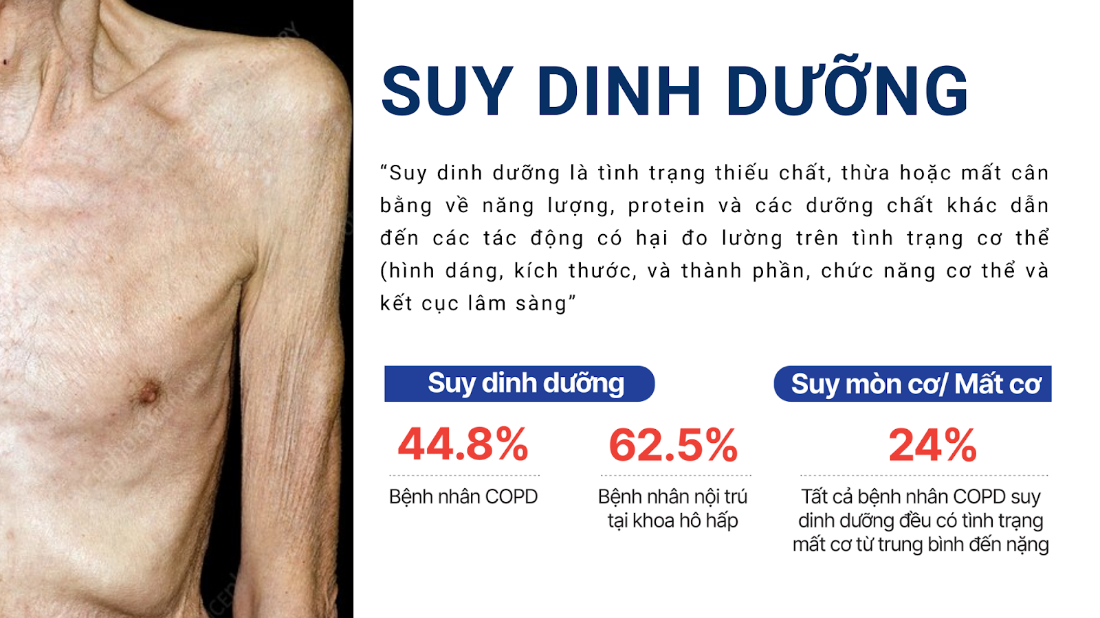 4 thực phẩm giàu protein thực vật - “Kho dinh dưỡng vàng” cho người mắc đàm ho khó thở liên miên! - 2